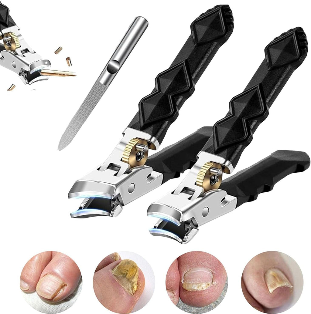Medical Grade Orthoclip Toenail Clippers Set - Wide Jaw & Angled Tip Clippers Fo